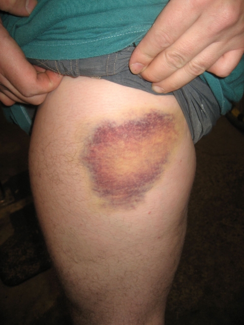 Pywacket Bruise